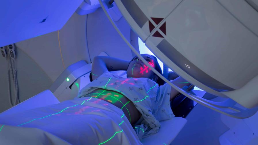 Radioterapia: avances en el tratamiento de tumores cerebrales Radioterapia: avances en el tratamiento de tumores cerebrales